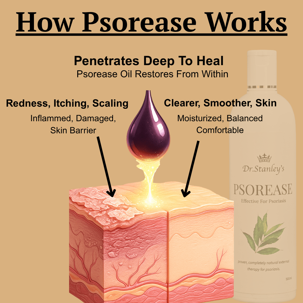 Psorease Psoriasis Treatment TETO 500ml